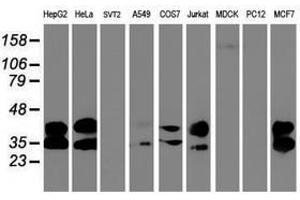 Image no. 5 for anti-Uracil-DNA Glycosylase (UNG) antibody (ABIN1501681)