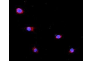 IF analysis of GLB1 using anti-GLB1 antibody (ABIN7599649).