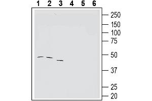 Western blot analysis of human K562 erythroleukemia cell line lysate (lanes 1 and 4), human Jurkat T-cell leukemia cell line lysate (lanes 2 and 5) and human LNCaP prostate adenocarcinoma cell line lysate (lanes 3 and 6):1-3.