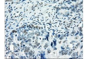 Immunohistochemical staining of paraffin-embedded colon tissue using anti-SATB1mouse monoclonal antibody. (SATB1 Antikörper)