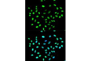 Immunofluorescence analysis of MCF-7 cells using HNRNPK antibody (ABIN5970850). (HNRNPK Antikörper)