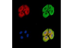 ABIN7096484 and ABIN7100548 staining Hela cells by IF/ICC. (TMEM107 Antikörper)