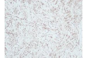Image no. 1 for anti-gamma-Interferon-Induced Monokine (CXCL9) antibody (ABIN465877) (CXCL9 Antikörper)