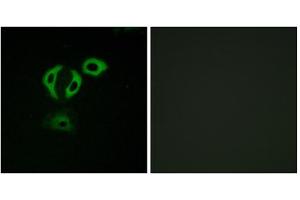 Immunofluorescence analysis of A549cells, using TACC3 antibody. (TACC3 Antikörper  (C-Term))