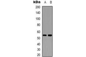 Western blot analysis of Cytochrome P450 2W1 expression in Hela (A), HepG2 (B) whole cell lysates. (CYP2W1 Antikörper)