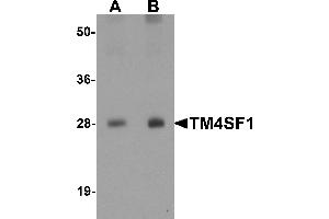 Western blot analysis of TM4SF1 in human lung tissue lysate with TM4SF1 antibody at (A) 0. (TM4SF1 Antikörper  (N-Term))