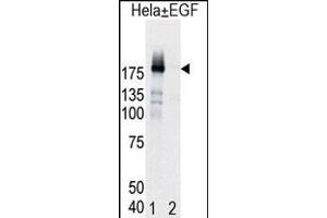 Western blot analysis of EGFR (arrow) in Hela cell lysates, either induced (Lane 1) or noninduced with EGF (Lane 2). (EGFR Antikörper  (pTyr998))