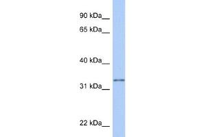 WB Suggested Anti-GSTO2 Antibody Titration:  0. (GSTO2 Antikörper  (Middle Region))