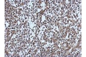 Image no. 1 for anti-Mdc1 (MDC1) (AA 642-954) antibody (ABIN1499348)