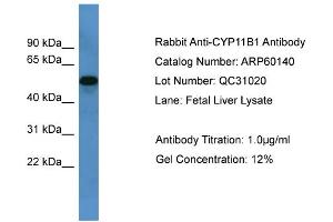 WB Suggested Anti-CYP11B1  Antibody Titration: 0. (CYP11B1 Antikörper  (C-Term))