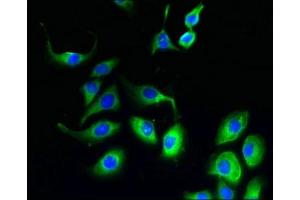 Immunofluorescent analysis of A549 cells using ABIN7152727 at dilution of 1:100 and Alexa Fluor 488-congugated AffiniPure Goat Anti-Rabbit IgG(H+L) (FATE1 Antikörper  (AA 1-162))