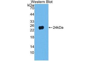 Western Blotting (WB) image for anti-Pronociceptin (AA 12-187) antibody (ABIN1980497) (Pronociceptin (AA 12-187) Antikörper)