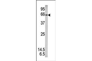 Image no. 1 for anti-Signal Transducer and Activator of Transcription 1, 91kDa (STAT1) (pSer727) antibody (ABIN358231) (STAT1 Antikörper  (pSer727))