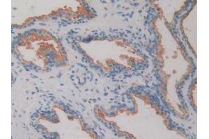 IHC-P analysis of Human Prostate Gland Tissue, with DAB staining. (DPP4 Antikörper  (AA 484-728))