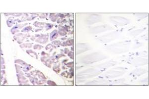 Immunohistochemistry analysis of paraffin-embedded human heart, using IKK-alpha (Phospho-Ser176) /IKK-beta (Phospho-Ser177) Antibody. (IKK alpha Antikörper  (pSer176))