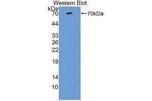 Western blot analysis of the recombinant protein. (Vitronectin Antikörper  (AA 19-468))
