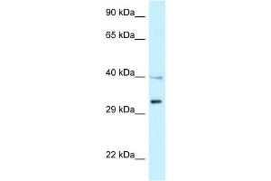 Western Blot showing TNFRSF14 antibody used at a concentration of 1 ug/ml against NCI-H226 Cell Lysate (HVEM Antikörper  (Middle Region))