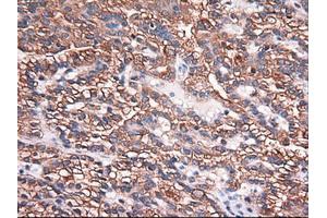 Image no. 1 for anti-Carboxypeptidase A1 (Pancreatic) (CPA1) (AA 1-419) antibody (ABIN1490771) (CPA1 Antikörper  (AA 1-419))