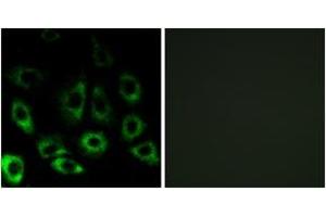 Immunofluorescence (IF) image for anti-Membrane-Bound Transcription Factor Peptidase, Site 2 (MBTPS2) (AA 301-350) antibody (ABIN2890405) (MBTPS2 Antikörper  (AA 301-350))
