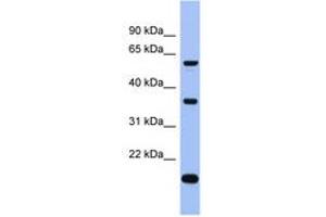 Image no. 1 for anti-La Ribonucleoprotein Domain Family, Member 6 (LARP6) (C-Term) antibody (ABIN6743023) (LARP6 Antikörper  (C-Term))