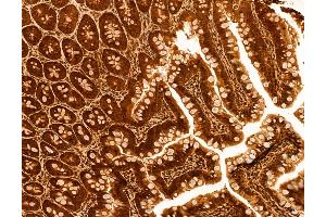 ABIN6259812 and ABIN6272986 at 1/100 staining Rat colon tissue by IHC-P. (ADRM1 Antikörper  (Internal Region))