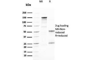 SDS-PAGE Analysis Purified CD25 Mouse Monoclonal Antibody (IL2RA/2394). (CD25 Antikörper  (AA 42-183))