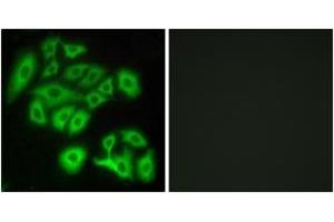 Immunofluorescence analysis of A549 cells, using FZD4 Antibody. (FZD4 Antikörper  (AA 131-180))