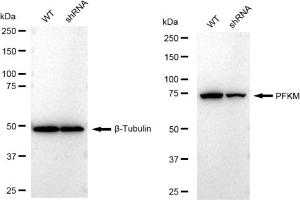 Western blotting analysis using PFKM antibody (ABIN7799801). (Rekombinanter PFKM Antikörper)
