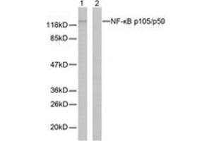 Western blot analysis of extracts from MDA-MB-435 cells, using NF-kappaB p105/p50 (Ab-337) Antibody. (NFKB1 Antikörper  (AA 304-353))