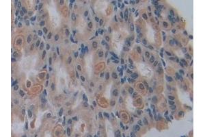 Immunohistochemistry (IHC) image for anti-Caspase 12 (Gene/pseudogene) (CASP12) (AA 1-413) antibody (ABIN7442993)
