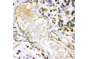 Immunohistochemistry (IHC) image for anti-Heme Oxygenase (Decycling) 1 (HMOX1) (AA 1-288) antibody (ABIN3042449)