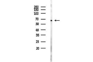 anti-GABA A Receptor delta (GABRD) (Internal Region) antibody
