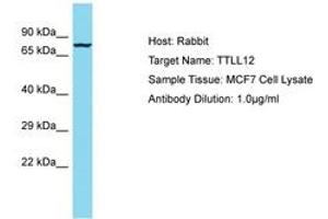 Image no. 1 for anti-Tubulin tyrosine Ligase-Like Family, Member 12 (TTLL12) (AA 73-122) antibody (ABIN6750588) (TTLL12 Antikörper  (AA 73-122))