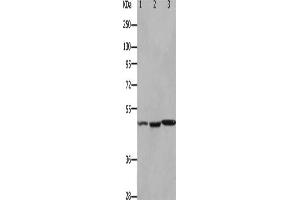 Gel: 10 % SDS-PAGE, Lysate: 40 μg, Lane 1-3: Mouse kidney tissue, Mouse brain tissue, Mouse heart tissue, Primary antibody: ABIN7190922(HCRTR2 Antibody) at dilution 1/1100, Secondary antibody: Goat anti rabbit IgG at 1/8000 dilution, Exposure time: 90 seconds (HCRTR2 Antikörper)