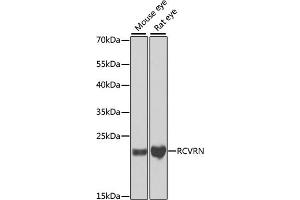 Recoverin Antikörper  (AA 1-200)