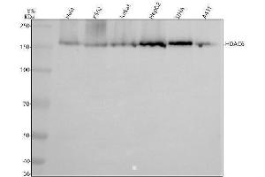 Western blot analysis of HDAC6 using anti-HDAC6 antibody (ABIN7605069).