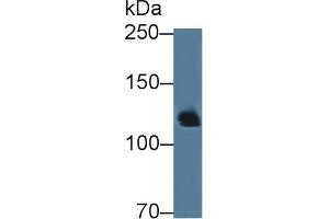 Detection of AMPH in Mouse Cerebrum lysate using Polyclonal Antibody to Amphiphysin (AMPH) (Amphiphysin Antikörper  (AA 24-240))