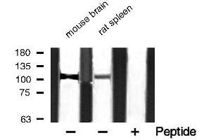 Western blot analysis of extracts of various smaple,using PMYPT1 (Phospho-Thr853) Antibody. (PPP1R12A Antikörper  (pThr853))