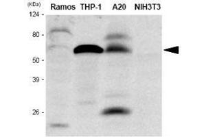 The extracts of Ramos, THP-1, A20 and NIH3T3 were resolved by SDS-PAGE, transferred to PVDF membrane and probed with anti-human IRF-5 antibody (1:1,000).
