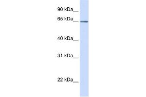 WB Suggested Anti-OPTN Antibody Titration:  0. (OPTN Antikörper  (C-Term))