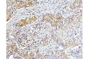 IHC analysis of EIF4A using anti-EIF4A antibody (ABIN7601309). (EIF4A1 Antikörper  (AA 32-406))