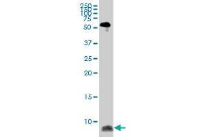 ATOX1 monoclonal antibody (M08), clone 4D6. (ATOX1 Antikörper  (AA 1-68))