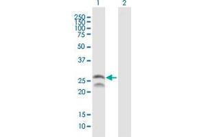 Western Blot analysis of FEV expression in transfected 293T cell line by FEV MaxPab polyclonal antibody. (FEV Antikörper  (AA 1-238))