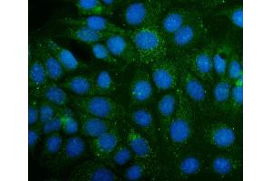 IF analysis of ABAT using anti-ABAT antibody (ABIN4886408). (ABAT Antikörper  (AA 388-500))