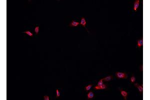ABIN6278174 staining HepG2? (FOXA1 Antikörper  (C-Term))