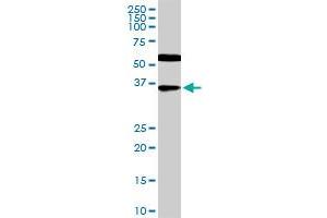 CDX4 monoclonal antibody (M12), clone 1E9. (CDX4 Antikörper  (AA 202-284))