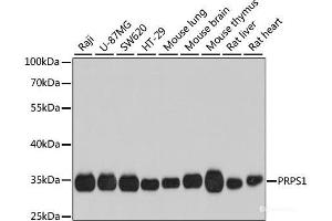 Western blot analysis of extracts of various cell lines using PRPS1 Polyclonal Antibody at dilution of 1:1000. (PRPS1 Antikörper)