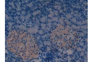Immunohistochemistry (IHC) image for anti-Regenerating Islet Derived Protein 3 gamma (REG3g) (AA 33-147) antibody (ABIN7439174)