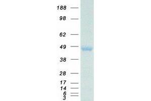 Western Blotting (WB) image for Homeobox A10 (HOXA10) (Transcript Variant 1) protein (Myc-DYKDDDDK Tag) (ABIN2722975)