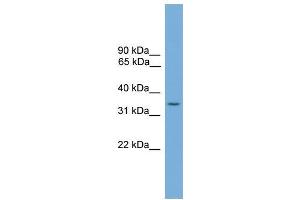 Human Jurkat; WB Suggested Anti-SLC35A4 Antibody Titration: 0. (SLC35A4 Antikörper  (Middle Region))